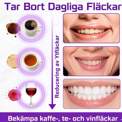 Whitening Strips – 42 remsor | Vita tänder på 7 dagar | NovaSmart